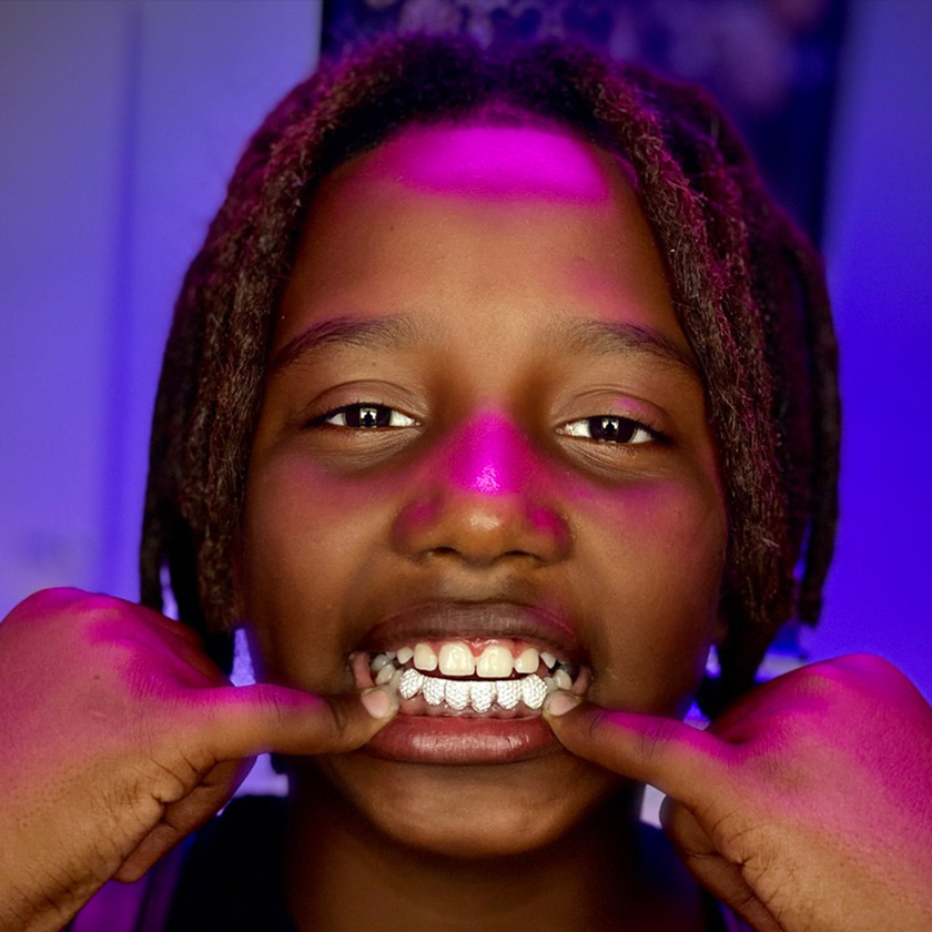 Grillz 6x Cravejado Prata - Imagem 4